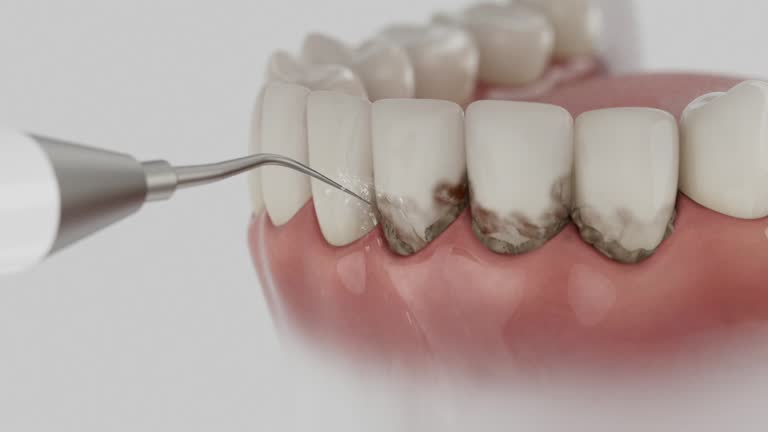Trusted Teeth Cleaning And Checkup service in Westport, WA - Dentist Open Now